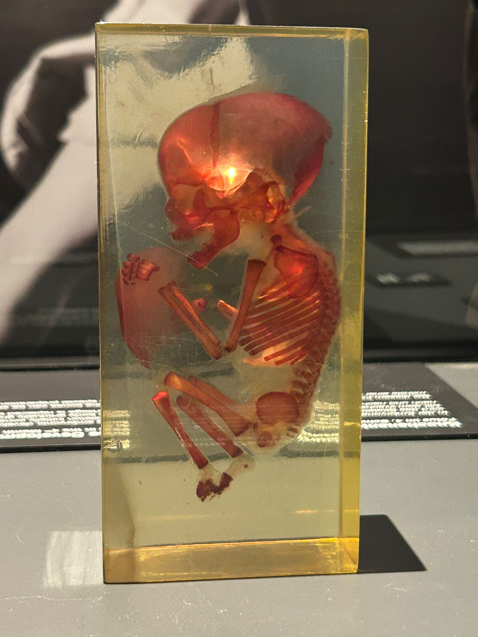 WhatsApp Image 2026-03-16 at 07.55.03 (1) WhatsApp Image 2026-03-16 at 07.55.03 (1)